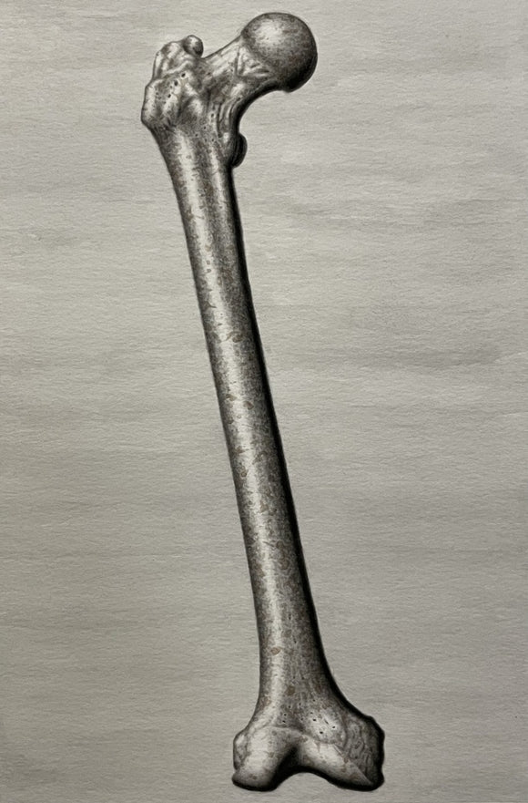 Metal Femur