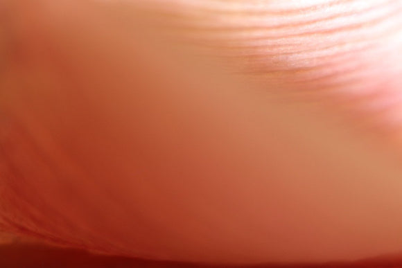 Tulip XVI