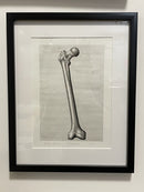 Metal Femur-2