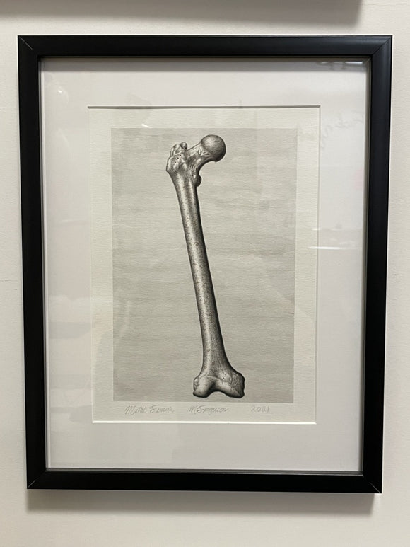 Metal Femur