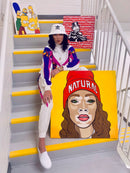 Winnie Harlow - VITILIGO BEAUTY-3