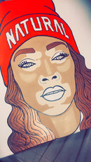 Winnie Harlow - VITILIGO BEAUTY-4