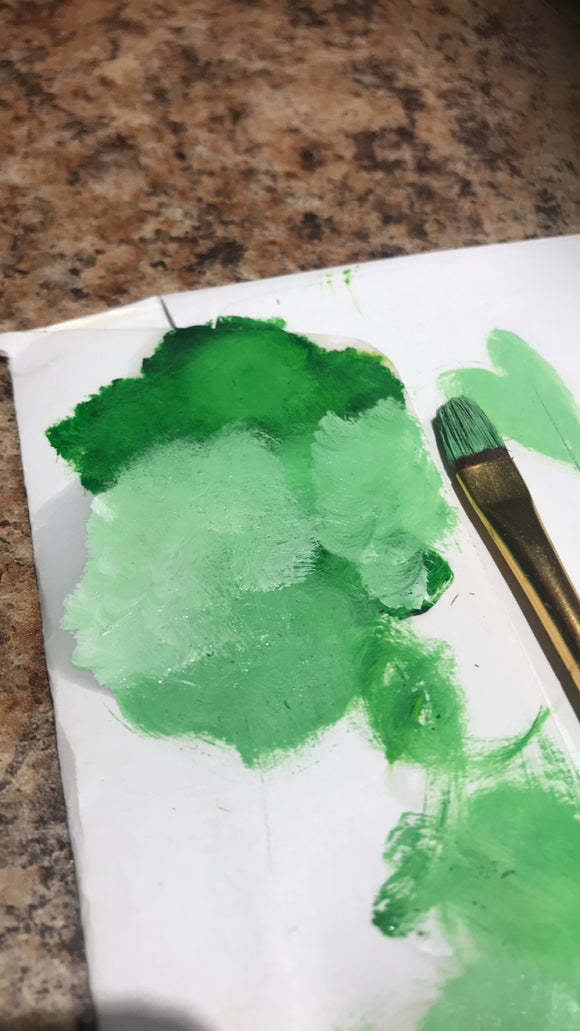 Winnie Harlow - VITILIGO BEAUTY