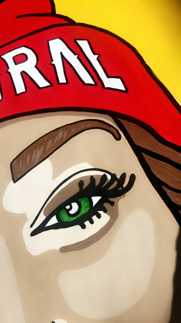 Winnie Harlow - VITILIGO BEAUTY